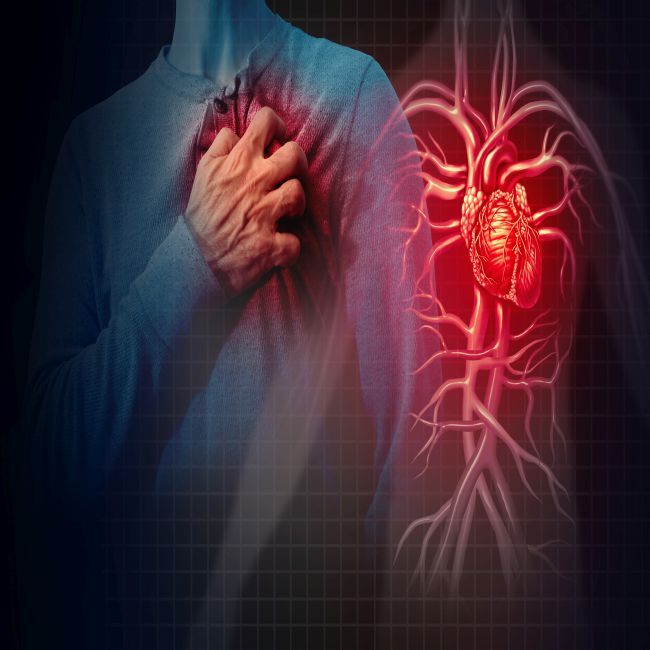 Grotere diameter van de aorta geeft risico op hartaanval